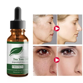 1PC Tea Tree Essential Oil Moisturizing Massage Oil Control Fade Acne Marks Shrink Pores Repair Moisturizing Skin Care TSLM1
1PC Tea Tree Essential Oil Moisturizing Massage Oil Control Fade Acne Marks Shrink Pores Repair Moisturizing Skin Care TSLM1