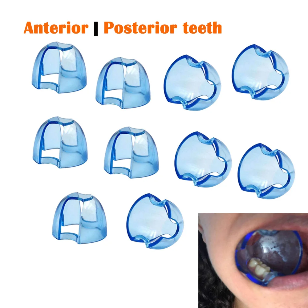 5 pcs Mouth Opener Dental Orthodontic Lip Cheek Retractor Expander Dental Mouth Accessory For anterior teeth posterior teeth
5 pcs Mouth Opener Dental Orthodontic Lip Cheek Retractor Expander Dental Mouth Accessory For anterior teeth posterior teeth