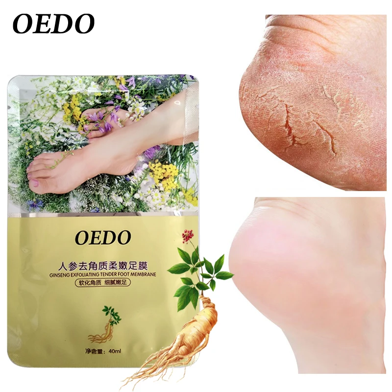 OEDO Feet Exfoliating Foot Mask Magic Skin Peeling Dead Skin Feet Mask Sock Whitening Moisturizing Soften Cutin Mask Foot Care
OEDO Feet Exfoliating Foot Mask Magic Skin Peeling Dead Skin Feet Mask Sock Whitening Moisturizing Soften Cutin Mask Foot Care
