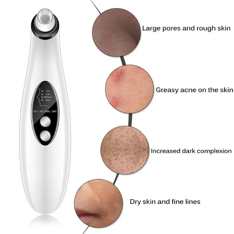 Blackhead Remover Skin Care Deep Pore Cleaner Acne Pimple Removal Suction Tool Four Kinds of Suckers Replace at Will
Blackhead Remover Skin Care Deep Pore Cleaner Acne Pimple Removal Suction Tool Four Kinds of Suckers Replace at Will