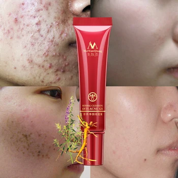 15ML Face Acne Cleaning Cream Skin Care Remove Repair Comedone Pimple Quickly Face Acne Cream Remover Anti Acne Treatment
15ML Face Acne Cleaning Cream Skin Care Remove Repair Comedone Pimple Quickly Face Acne Cream Remover Anti Acne Treatment