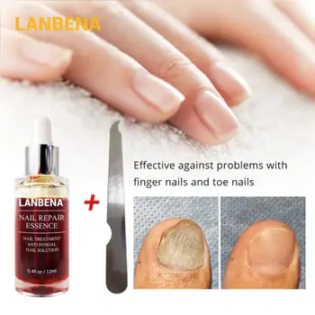 LANBENA 12ml Nail Repair Treatments Essence Remove Onychomycosis Serum Nail Art Nail Brighten Hand Foot Nail Care Essence TSLM1
LANBENA 12ml Nail Repair Treatments Essence Remove Onychomycosis Serum Nail Art Nail Brighten Hand Foot Nail Care Essence TSLM1