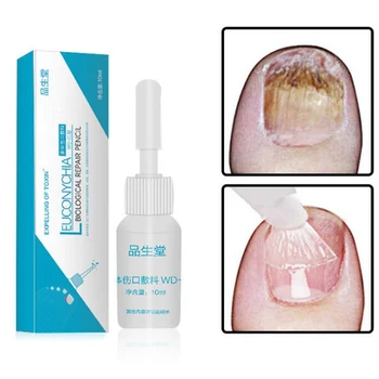 10ml Nail Fungus Treatment Nail Repair Liquid Armor Sterilization Treatment Onychomycosis Remover Nail Care Tool TSLM1
10ml Nail Fungus Treatment Nail Repair Liquid Armor Sterilization Treatment Onychomycosis Remover Nail Care Tool TSLM1