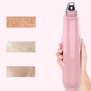 Blackhead Remover Face Deep Pore Cleaner Acne Pimple Removal Vacuum Suction Facial SPA Beauty Care Tool Skin Care Extractor
Blackhead Remover Face Deep Pore Cleaner Acne Pimple Removal Vacuum Suction Facial SPA Beauty Care Tool Skin Care Extractor