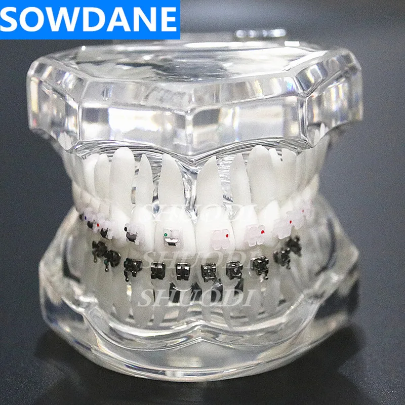 

Dental Orthodontic Model Patients Communication 4 kinds Brackets with Ceramic Self Ligating Bracket Metal Self Ligating