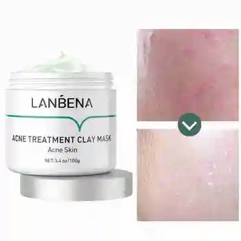 Acne Treatment Clay Mask Acne Skin Deep Cleansing Remove Chronic Acnes Grease Completely Oil Controlling Firming Pores
Acne Treatment Clay Mask Acne Skin Deep Cleansing Remove Chronic Acnes Grease Completely Oil Controlling Firming Pores