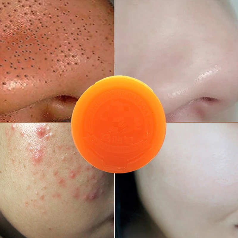 Horse Oil Soap Moisturizing Handmade Soap Face Care Acne Treatment Blackhead Remover Oil Control Cleanser Bath TSLM1
Horse Oil Soap Moisturizing Handmade Soap Face Care Acne Treatment Blackhead Remover Oil Control Cleanser Bath TSLM1