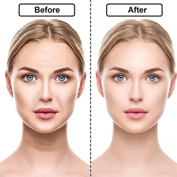 Lip Wrinkle Remover Pad Reusable Grade Silicone Nasolabial Folds Mask Prevent Wrinkle Anti-aging Face O6W9
Lip Wrinkle Remover Pad Reusable Grade Silicone Nasolabial Folds Mask Prevent Wrinkle Anti-aging Face O6W9