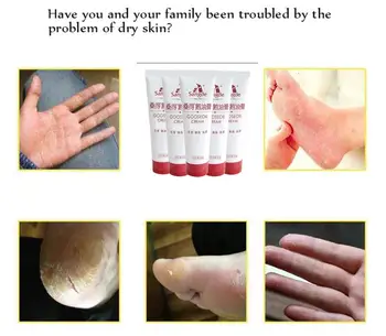 Heel Chapped Peeling Foot Free Shipping Hand Repair Anti Dry Cracked Ointment Cream Skin Repair Moisturizing Foot Cream
Heel Chapped Peeling Foot Free Shipping Hand Repair Anti Dry Cracked Ointment Cream Skin Repair Moisturizing Foot Cream
