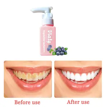 VIBRANT GLAMOUR Blueberry Toothpaste Stain Removal Whitening Viaty Toothpaste Fight Bleeding Gums Bottled Toothpaste
VIBRANT GLAMOUR Blueberry Toothpaste Stain Removal Whitening Viaty Toothpaste Fight Bleeding Gums Bottled Toothpaste