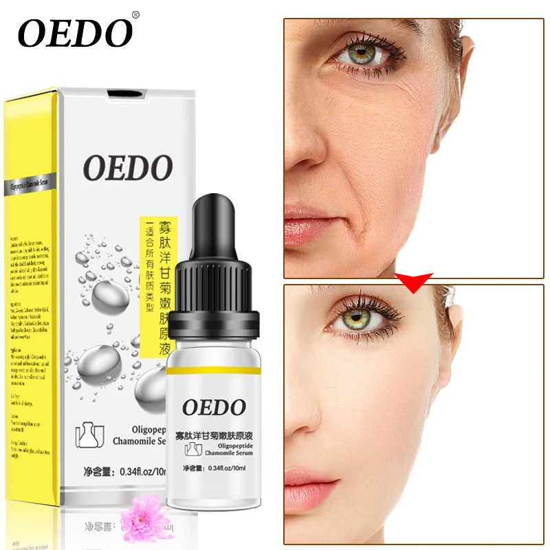 OEDO Oligopeptide Chamomile Serum Niacinamide Whitening Essence Moisturizing Anti Wrinkle Anti-Aging Brightening Skin Face Care
OEDO Oligopeptide Chamomile Serum Niacinamide Whitening Essence Moisturizing Anti Wrinkle Anti-Aging Brightening Skin Face Care