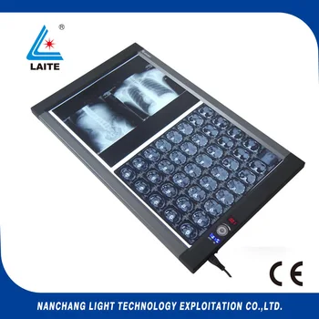 LED Viewing Box, X Ray Viewer, Negatoscope, Medical Film Viewer Double Screen Zg-2c
LED Viewing Box, X Ray Viewer, Negatoscope, Medical Film Viewer Double Screen Zg-2c