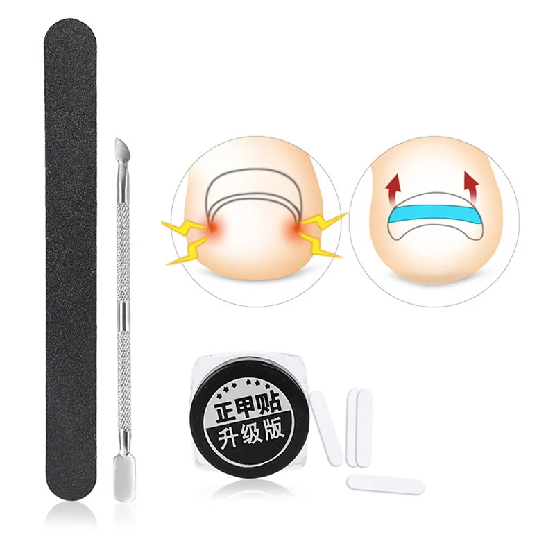 Stainless Ingrown Foot Care Tool Toe Nail Fixer Pedicure Recover Embed Toenail Correction Lifter Tool Kit Inset Buckle Hot
Stainless Ingrown Foot Care Tool Toe Nail Fixer Pedicure Recover Embed Toenail Correction Lifter Tool Kit Inset Buckle Hot