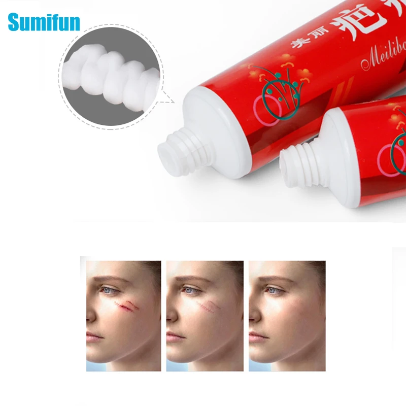 Sumifun 60g Skin Care Scar Removal Cream for New Old Scars Stretch Marks Remover Acne Treatment Herbal Ointment P1146
Sumifun 60g Skin Care Scar Removal Cream for New Old Scars Stretch Marks Remover Acne Treatment Herbal Ointment P1146