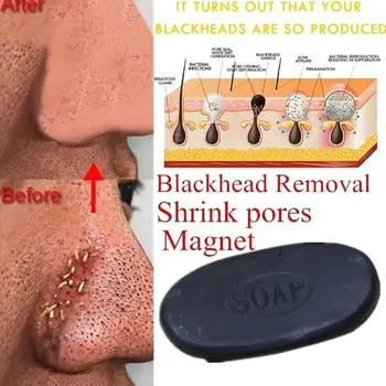Active Energy Bactericidal Soap Tourmaline Soap Oil-control Acne Body Blackhead Treatment Hand Remover Healthy Face Soap Ca T0L4
Active Energy Bactericidal Soap Tourmaline Soap Oil-control Acne Body Blackhead Treatment Hand Remover Healthy Face Soap Ca T0L4
