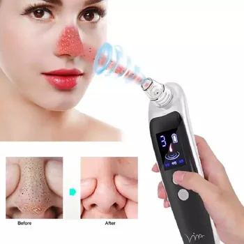 Vacuum Nose Blackhead Remover Black Spot Dots Whitehead Pimple Removal Suction Machine Rechargeable Pore Cleaner Facial Tools
Vacuum Nose Blackhead Remover Black Spot Dots Whitehead Pimple Removal Suction Machine Rechargeable Pore Cleaner Facial Tools