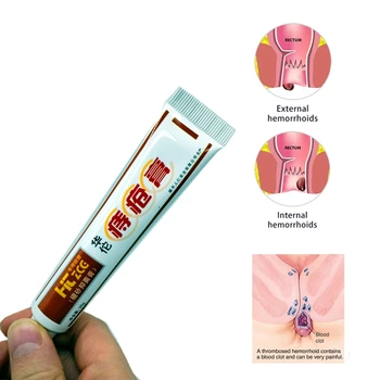 Cold Compress Hemorrhoids Ointment Powerful Analgesic Cream Internal Hemorrhoids Essential Oil Piles Treatment Plasters 10Pcs
Cold Compress Hemorrhoids Ointment Powerful Analgesic Cream Internal Hemorrhoids Essential Oil Piles Treatment Plasters 10Pcs
