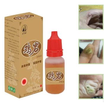10ml Body Warts Treatment Cream Chinese Traditional Foot Corn Removal Patch Plantar Genital Warts Ointment Foot Care Cream D115
10ml Body Warts Treatment Cream Chinese Traditional Foot Corn Removal Patch Plantar Genital Warts Ointment Foot Care Cream D115