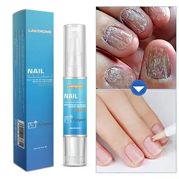 Nail Fungal Treatment Pen Antibacterial film Anti Fungus Infection Biological Repair Solution Nutritious Oil Nail Repair Pencil
Nail Fungal Treatment Pen Antibacterial film Anti Fungus Infection Biological Repair Solution Nutritious Oil Nail Repair Pencil