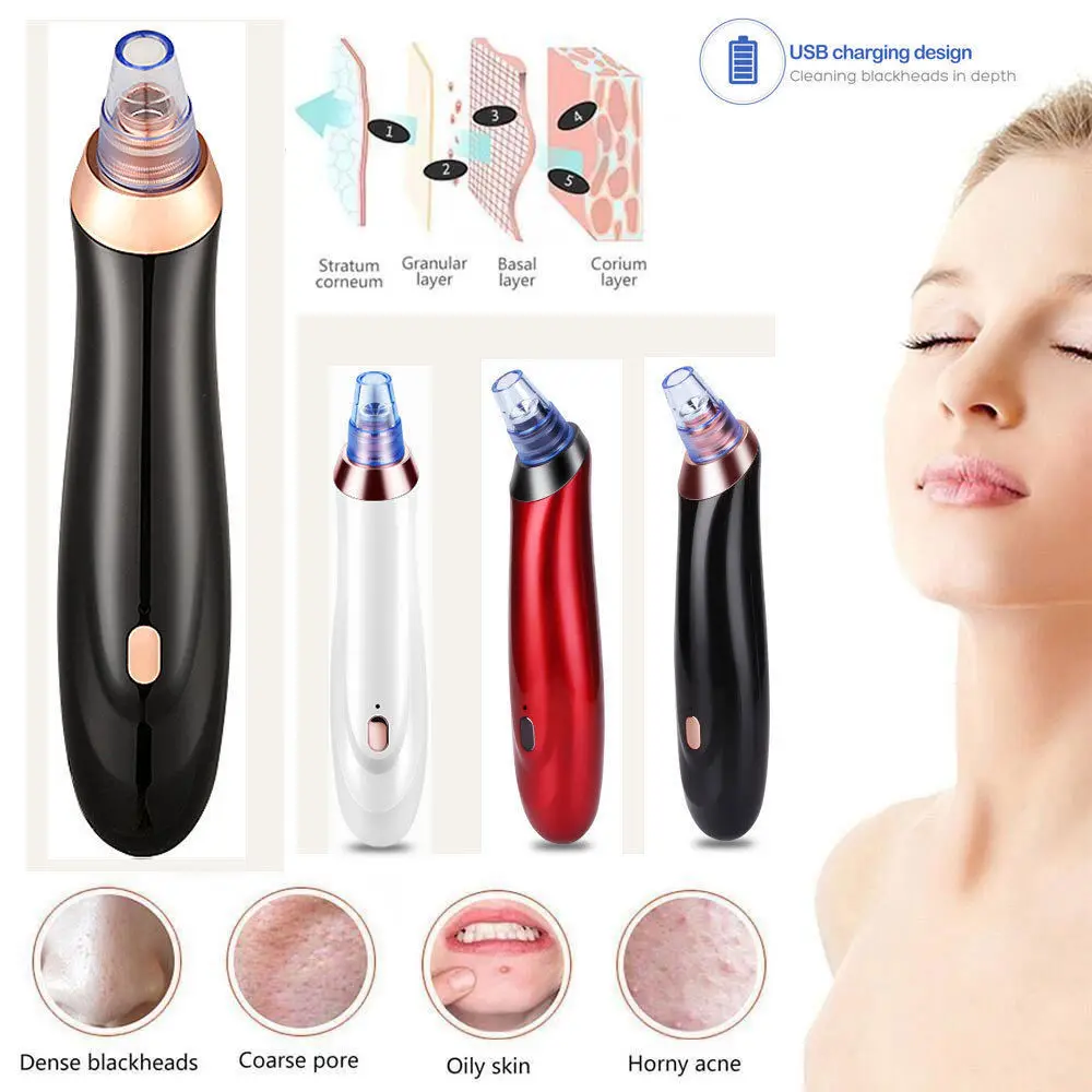 Face Acne Black Dot Pimple Blackhead Remover Electric Microcrystalline Blackhead Pore Blackhead Skin Care Machine
Face Acne Black Dot Pimple Blackhead Remover Electric Microcrystalline Blackhead Pore Blackhead Skin Care Machine