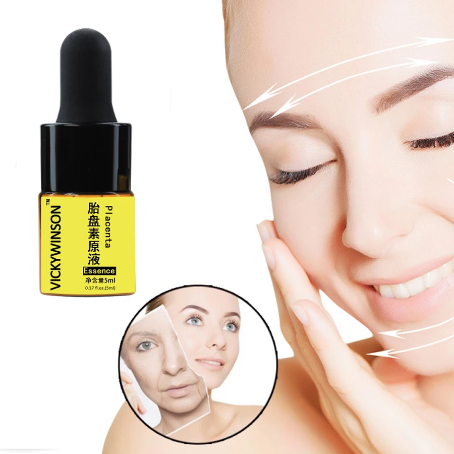 Astaxanthin essence 5ml Anti-Wrinkle Remover Dark Circles Eye Essence Against Puffiness and Bags Eye Care
Astaxanthin essence 5ml Anti-Wrinkle Remover Dark Circles Eye Essence Against Puffiness and Bags Eye Care
