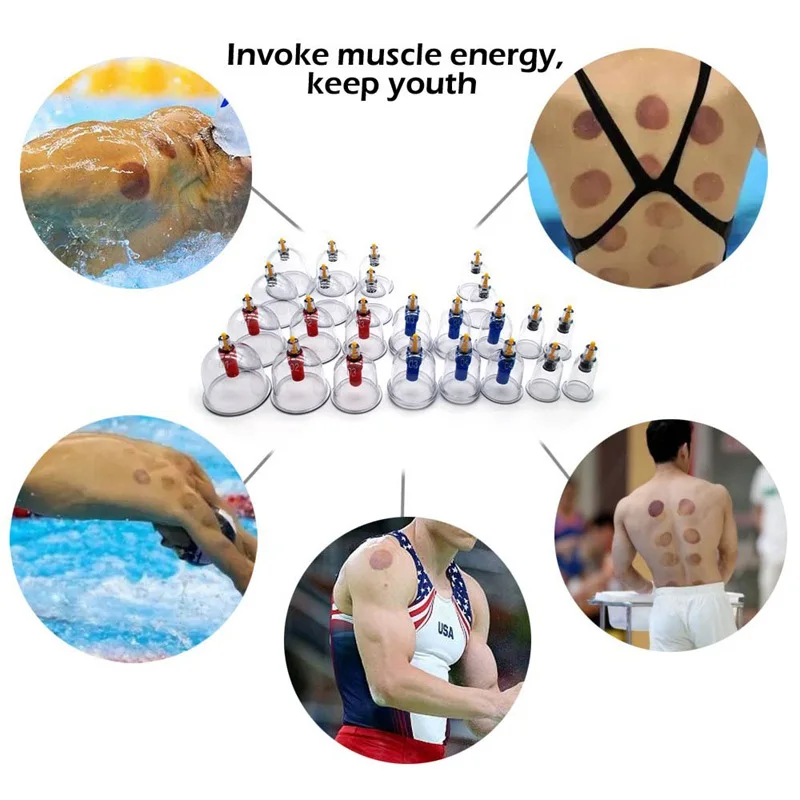 24Pcs Cupping Sets | Cupping Vacuum Suction 24 Cups Sets for Cellulite Cupping Massage Back | Chinese Cupping Pump 24Pcs Cupping Sets | Cupping Vacuum Suction 24 Cups Sets for Cellulite Cupping Massage Back | Chinese Cupping Pump