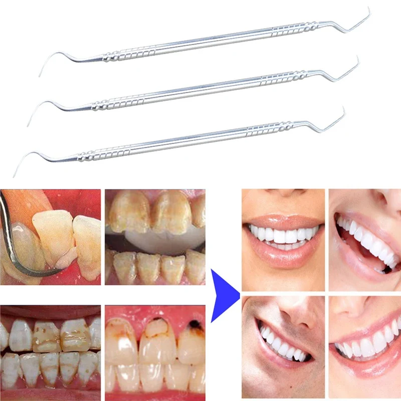 1 PCS Stainless Steel Double Ends Dentist Teeth Clean Hygiene Explorer Probe hook Pick Dental Tool Products
1 PCS Stainless Steel Double Ends Dentist Teeth Clean Hygiene Explorer Probe hook Pick Dental Tool Products
