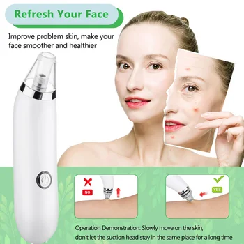 White ABS Black Head Cleaner Cosmetic Instrument Fast Fashion Blackhead Blackhead Removal Equipment Facial Clean Clear
White ABS Black Head Cleaner Cosmetic Instrument Fast Fashion Blackhead Blackhead Removal Equipment Facial Clean Clear