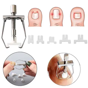 1 Pcs Toe Nail Fixer Pedicure Recovers Embed Toenail Nail Set Correction Ingrowing Care For Toes Foot Corrector Tool Lifter X9J2
1 Pcs Toe Nail Fixer Pedicure Recovers Embed Toenail Nail Set Correction Ingrowing Care For Toes Foot Corrector Tool Lifter X9J2
