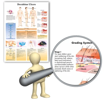 WANGART Decubitus Ulcers Chart Art Poster Print Body Map Canvas Wall Pictures for Medical Education Home Decor
WANGART Decubitus Ulcers Chart Art Poster Print Body Map Canvas Wall Pictures for Medical Education Home Decor