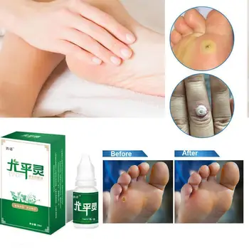 1PC Callus Removal Liquid Corn Treatment Liquid Remove Liquid Skin Skin Corns Calluses Dead Removal Care Exfoliator Foot I6O5
1PC Callus Removal Liquid Corn Treatment Liquid Remove Liquid Skin Skin Corns Calluses Dead Removal Care Exfoliator Foot I6O5