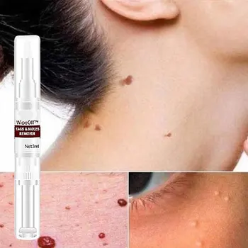 Wart Removal Pen Non-greasy Easy to Absorb No Scars Pain Warts Mole Repair Natural Beauty Easy to Carry Unisex Skin Care 5ml
Wart Removal Pen Non-greasy Easy to Absorb No Scars Pain Warts Mole Repair Natural Beauty Easy to Carry Unisex Skin Care 5ml
