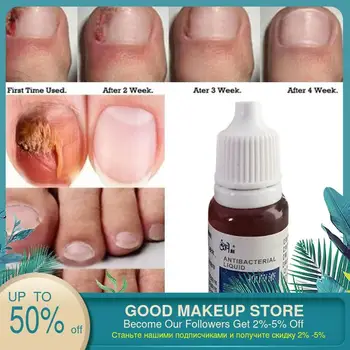 5ml Fungal Nail Treatment Liquid Bright Nail Repair Onychomycosis Removal Anti Infection Foot finger Care
5ml Fungal Nail Treatment Liquid Bright Nail Repair Onychomycosis Removal Anti Infection Foot finger Care