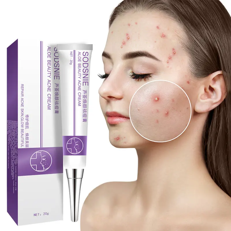 Aloe Beauty Acne Cream Moisturizing Oil-Control Repair Cleaning Pores Even Skin Tone Natural Hydrolyzed Algin Face Skin Care 20g
Aloe Beauty Acne Cream Moisturizing Oil-Control Repair Cleaning Pores Even Skin Tone Natural Hydrolyzed Algin Face Skin Care 20g