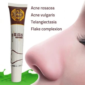 Skin antibacterial cream antibacterial cleansing care to solve skin itching problems common rosacea antibacterial ointment
Skin antibacterial cream antibacterial cleansing care to solve skin itching problems common rosacea antibacterial ointment