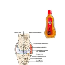 15ml Nature chenille chinoise champignon lumahar huiles essentielles taille médicale psoatique souche patchs articulations douleur raide cou soins(China)