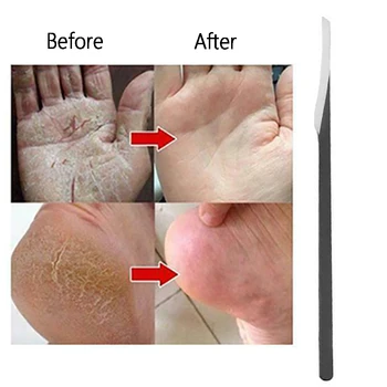 Foot Scraper Portable Calluses Planing Cleaning Professional Toe Seam Tungsten Steel Cuticle Remover Trimmer Pedicure Tool Home 
Foot Scraper Portable Calluses Planing Cleaning Professional Toe Seam Tungsten Steel Cuticle Remover Trimmer Pedicure Tool Home