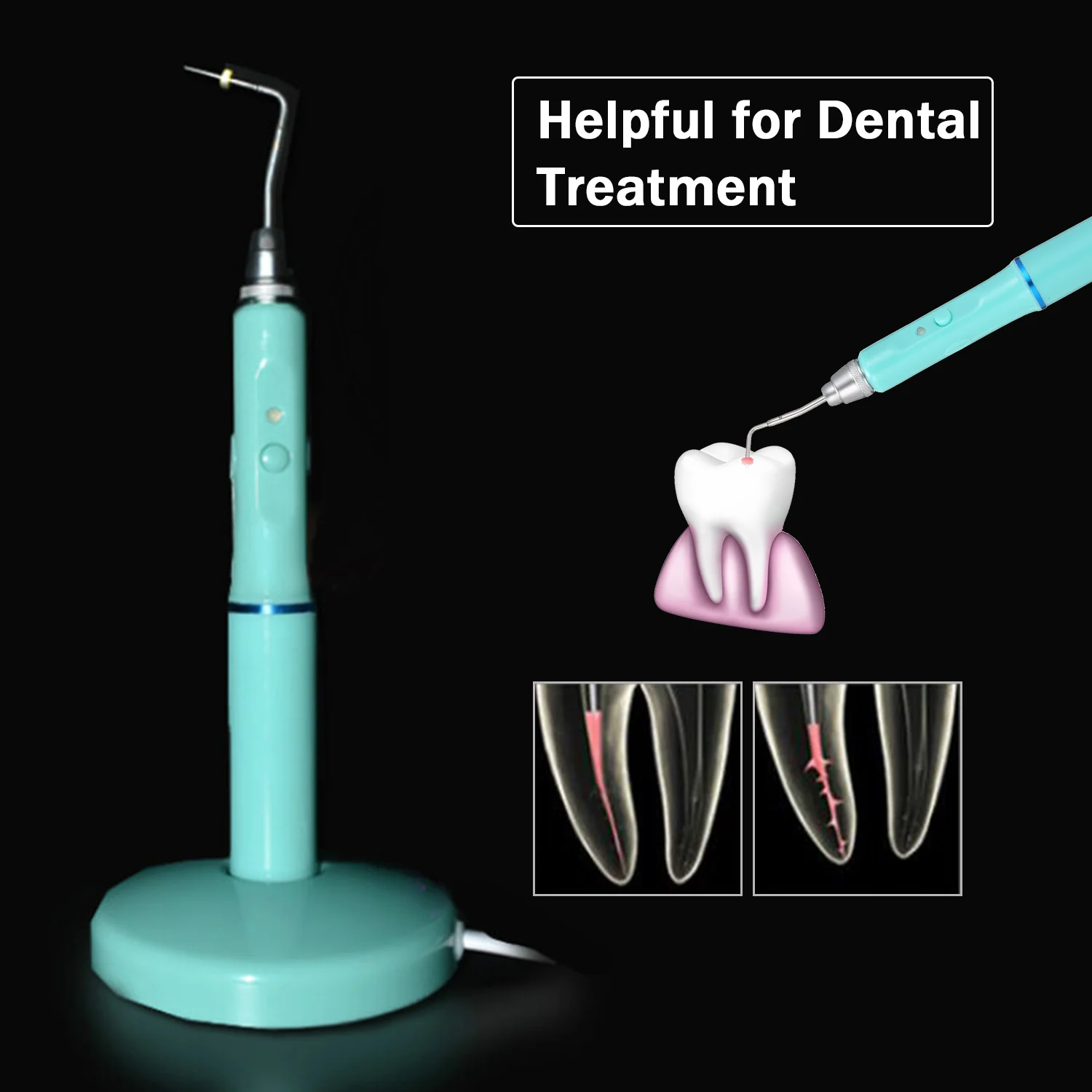 Electric Obturation Pen Cordless Gutta Percha Obturation System Endodontic Heated Pen with 2 Tips Dentist Tools Oral Care
Electric Obturation Pen Cordless Gutta Percha Obturation System Endodontic Heated Pen with 2 Tips Dentist Tools Oral Care