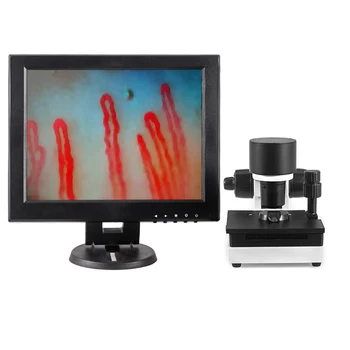12 inch Electron microcirculation microscope Blood shap and blood flow analysis health care Device
12 inch Electron microcirculation microscope Blood shap and blood flow analysis health care Device