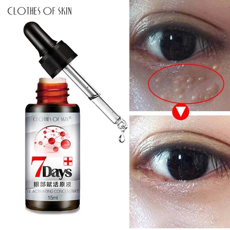 New Reduce Fat Granules Eye Serum Improve Eye Bag Dark Circles Eye Essence Remove Particles Anti-Puffiness Anti Wrinkle Eye Care
New Reduce Fat Granules Eye Serum Improve Eye Bag Dark Circles Eye Essence Remove Particles Anti-Puffiness Anti Wrinkle Eye Care