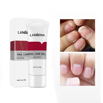 Nail Care Gel Fungal Treatment Remove OnychomycosisSoften The Texture Of Your Nails And Restore Their Health. 20g
Nail Care Gel Fungal Treatment Remove OnychomycosisSoften The Texture Of Your Nails And Restore Their Health. 20g