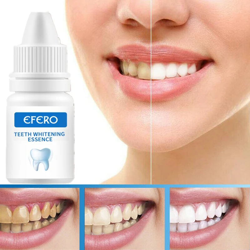 Teeth Whitening Cleaner Detergent Oral Hygiene Cleaning Teeth Care Bleaching Tool
Teeth Whitening Cleaner Detergent Oral Hygiene Cleaning Teeth Care Bleaching Tool