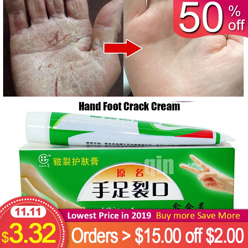 2Pcs/lot Chinese Cosmetics Hand Foot Crack Cream Heel Chapped Peeling Repair Anti Dry Crack Ointment Exfoliating Foot Cream
2Pcs/lot Chinese Cosmetics Hand Foot Crack Cream Heel Chapped Peeling Repair Anti Dry Crack Ointment Exfoliating Foot Cream