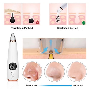 Acne pore cleaner remove acne vacuum suction tool USB rechargeable blackhead remover facial pore skin care 
Acne pore cleaner remove acne vacuum suction tool USB rechargeable blackhead remover facial pore skin care