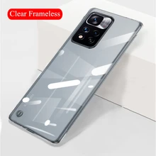 Frameless Transparent Case for Xiaomi Redmi Note 11 Pro Cover Clear Hard Plastic For Redmi Note 11 5G Fundas
Frameless Transparent Case for Xiaomi Redmi Note 11 Pro Cover Clear Hard Plastic For Redmi Note 11 5G Fundas