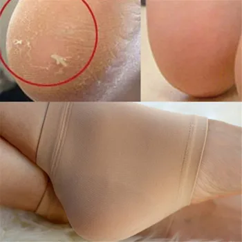 1Pair Silicone Moisturizing Gel Heel Socks Cracked Foot Skin Care Protectors Heel Pain Relief Insoles Feet Massager Tool
1Pair Silicone Moisturizing Gel Heel Socks Cracked Foot Skin Care Protectors Heel Pain Relief Insoles Feet Massager Tool