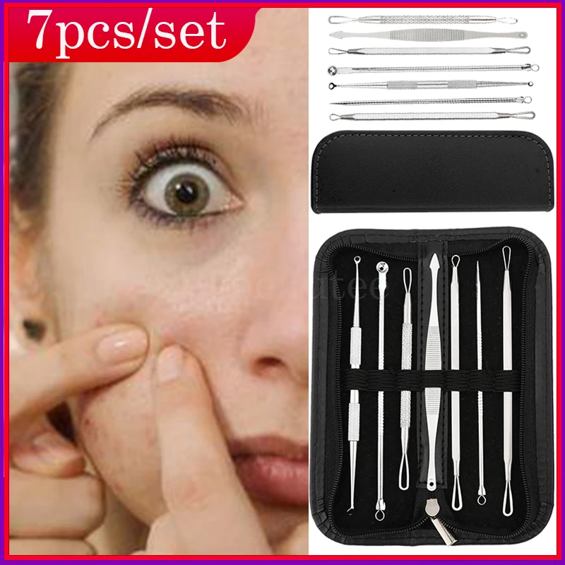Set for Acne Blackheads Acne 7 Pieces Remove Black Dots Points Comedones Extractor Prick Loops Tweezers Spoons for Face Cleaning
Set for Acne Blackheads Acne 7 Pieces Remove Black Dots Points Comedones Extractor Prick Loops Tweezers Spoons for Face Cleaning