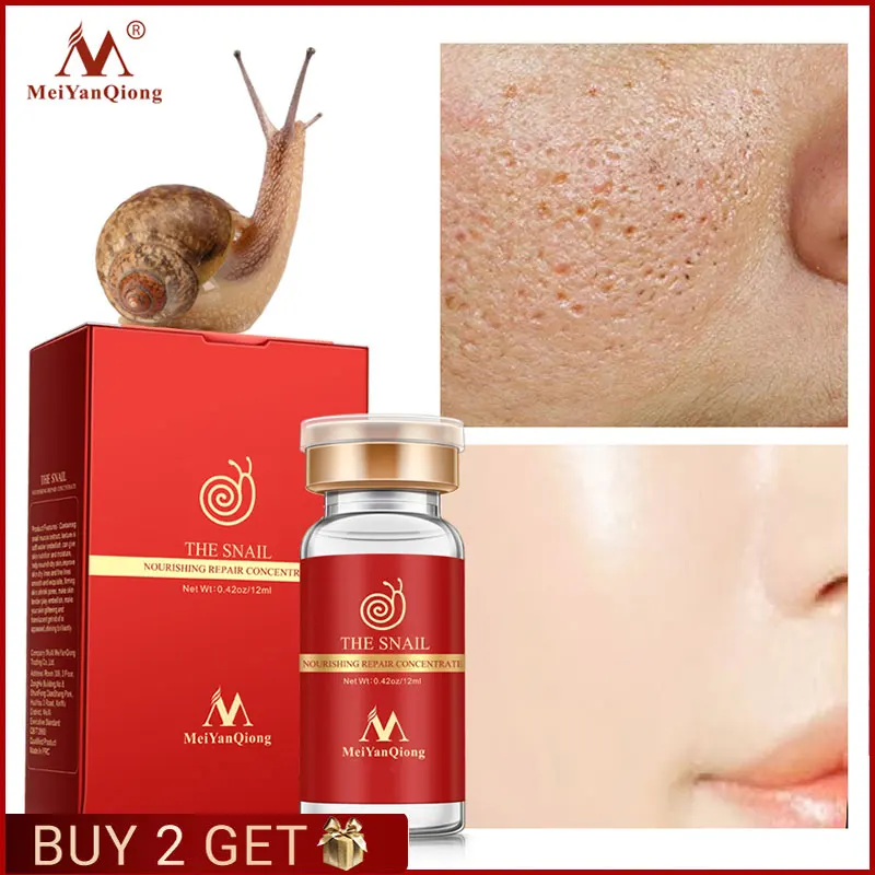 Snail Essence Hyaluronic Acid Shrink Pore Lifting Firming Face Serum Whitening Anti-Aging Regenerative Ampoule Anti-Acne Essence
Snail Essence Hyaluronic Acid Shrink Pore Lifting Firming Face Serum Whitening Anti-Aging Regenerative Ampoule Anti-Acne Essence