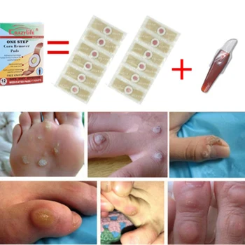 12pcs Wart Removal Patch Painlessly Remove Feet Callus Cutins Corn maquiagem Remover Pads Foot Care+Pedicure Knife -
12pcs Wart Removal Patch Painlessly Remove Feet Callus Cutins Corn maquiagem Remover Pads Foot Care+Pedicure Knife -