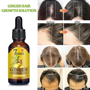 Fast Hair Growth Essence Healthy Baldness Alopecia Beauty 30ml Ginger Extract Increase Nutrition Hair Growth Fluid
Fast Hair Growth Essence Healthy Baldness Alopecia Beauty 30ml Ginger Extract Increase Nutrition Hair Growth Fluid